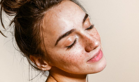 What to do if your eyelashes are falling out
