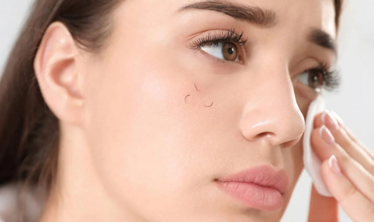 What to do if your eyelashes are falling out